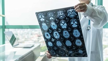 Stroke increasing Stroke increasing among younger adults know its causes and prevention tips